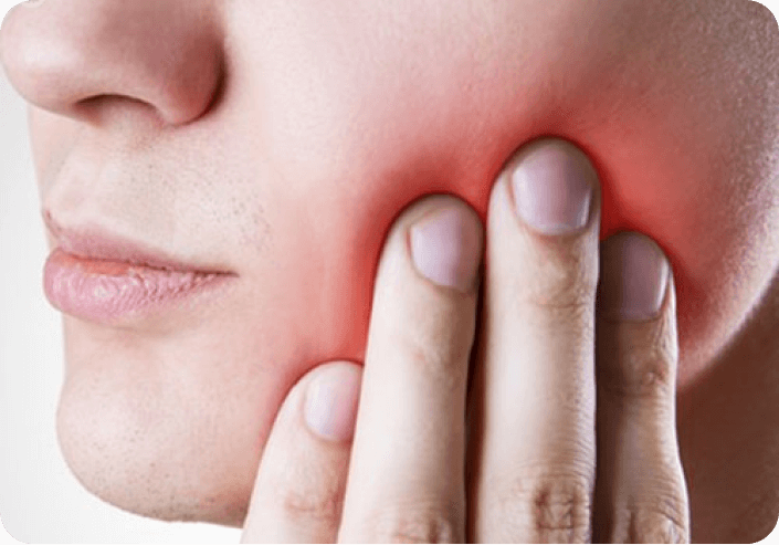 Trigeminal Neuralgia