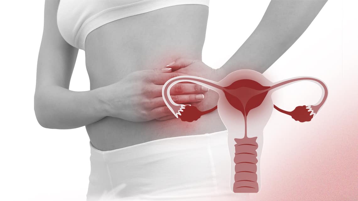 Pelvic Inflammatory Disease (PID)