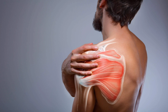 Shoulder Bursitis