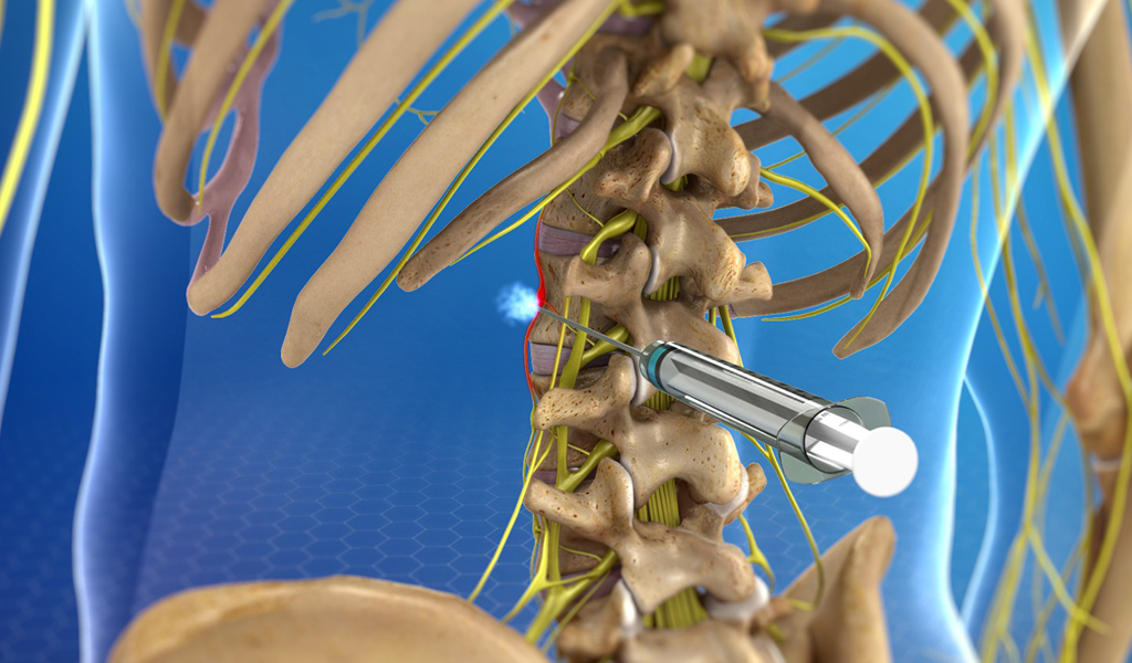 Sympathetic Nerve Block