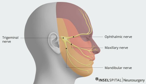 Neuralgia / Trigeminal Neuralgia