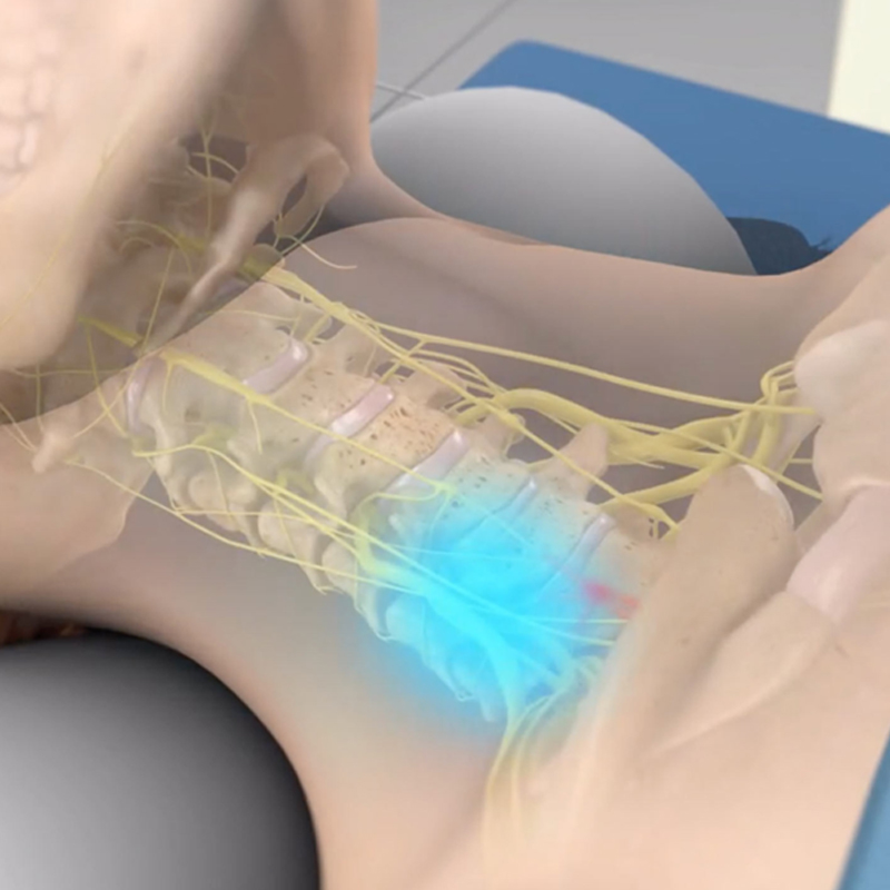 Stellate Ganglion Nerve Block
